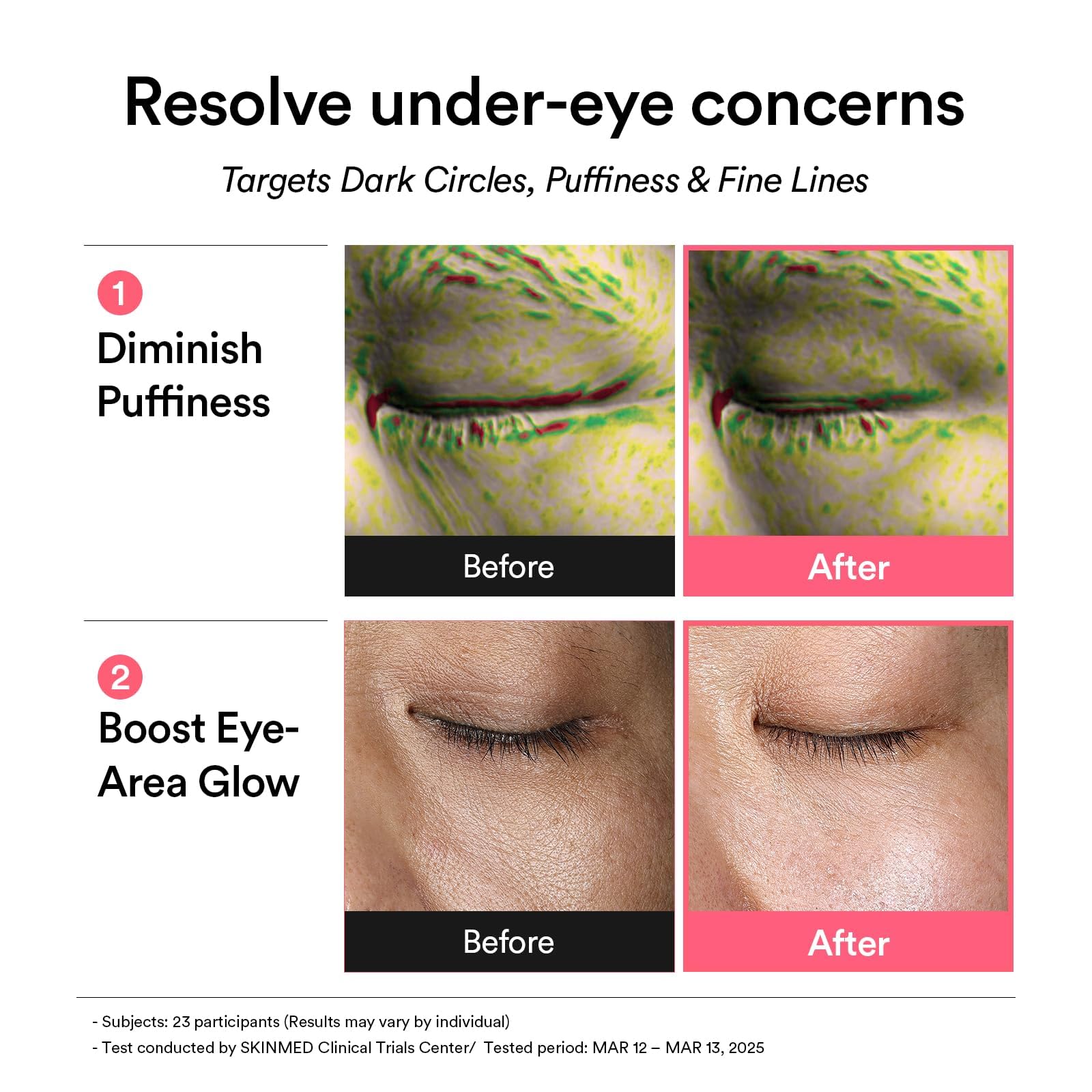 Abib retinal anti-aging eye patches applied to forehead lines