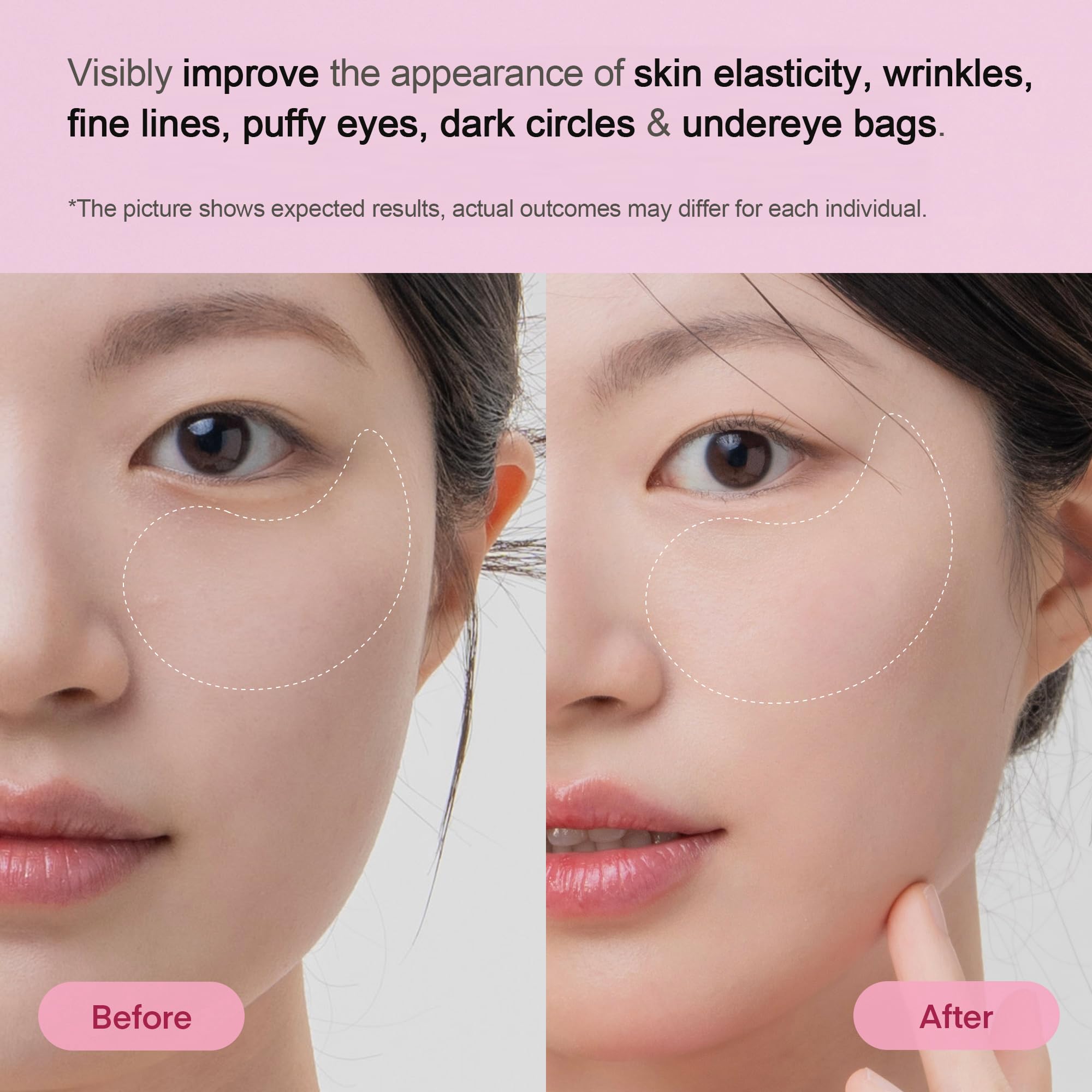 Korean inspired firming under eye gel patches for wrinkles and fine lines reduction