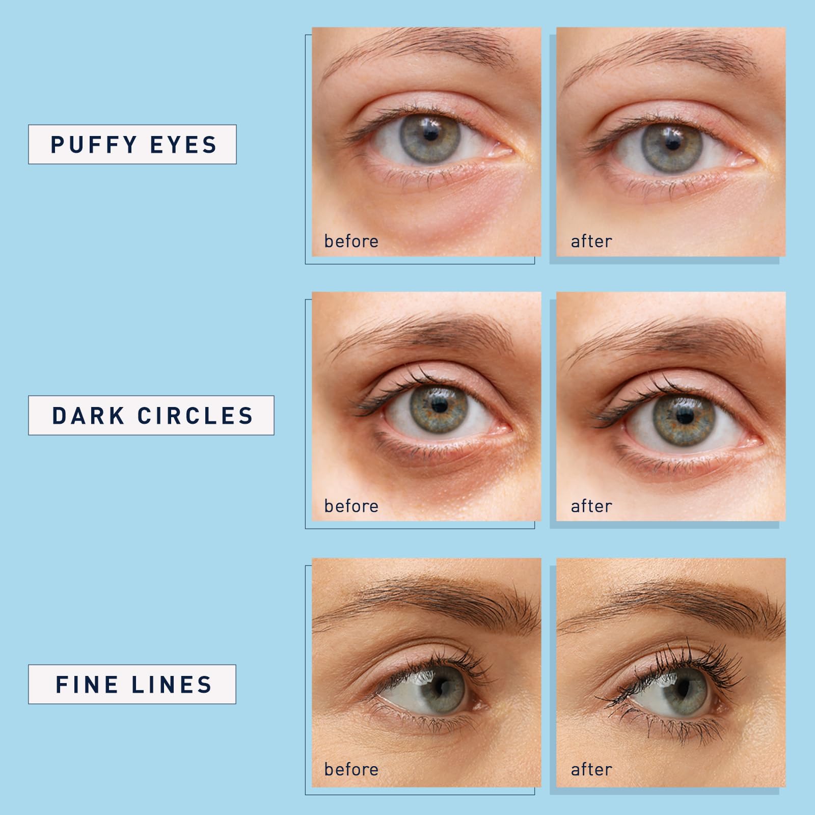 Under eye treatment pads application process on clean skin for wrinkles and puffiness