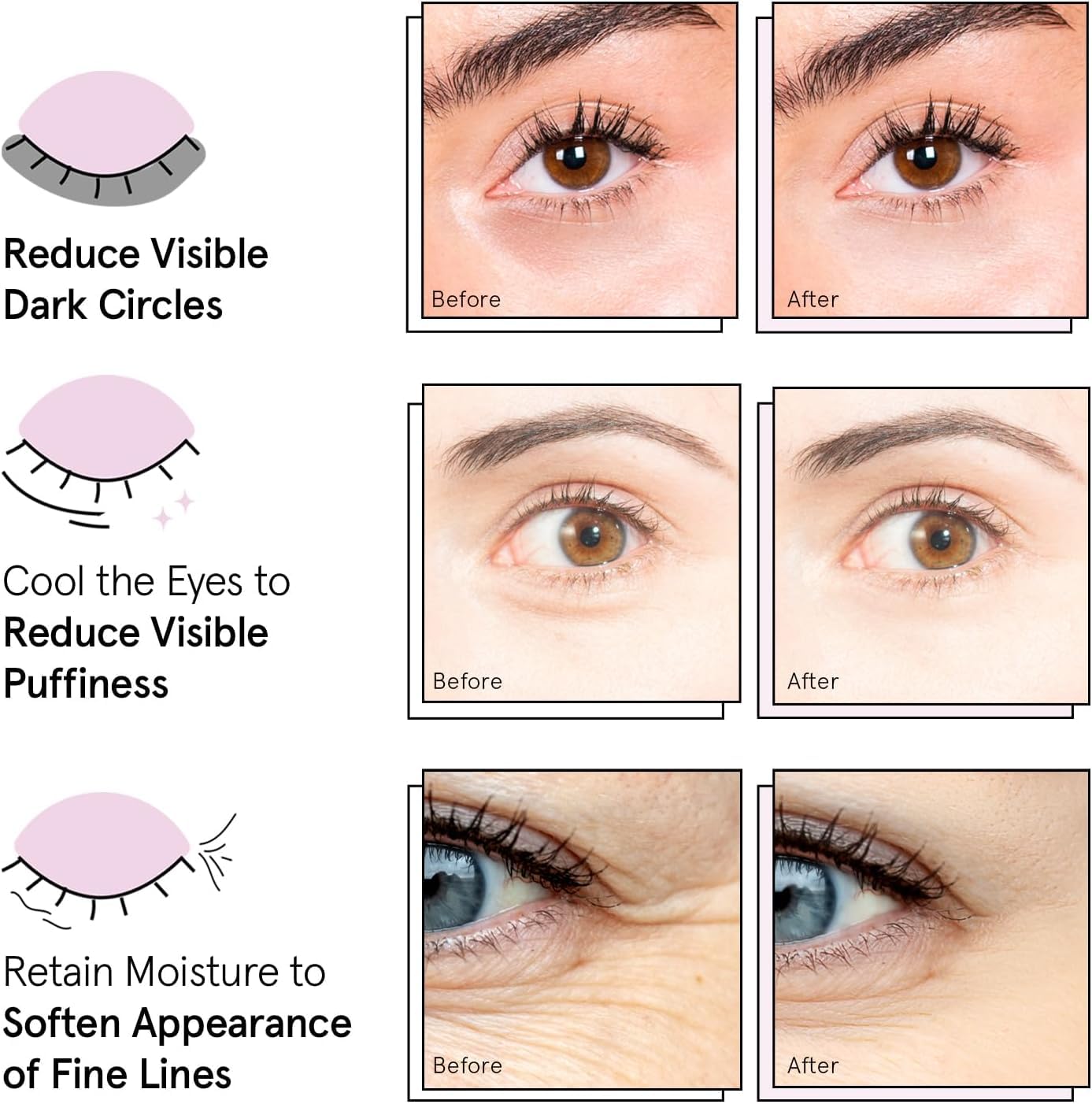 Results focused image showing refreshed under eye area