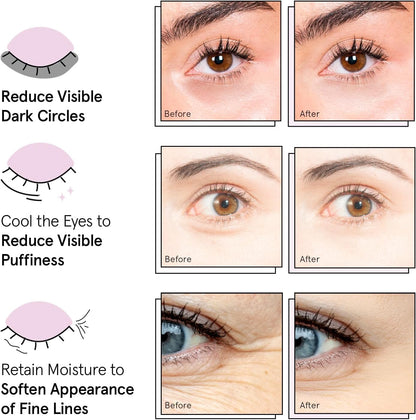 Results focused image showing refreshed under eye area