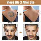 Demonstration of skin tone matching using NOBA dual color concealer system