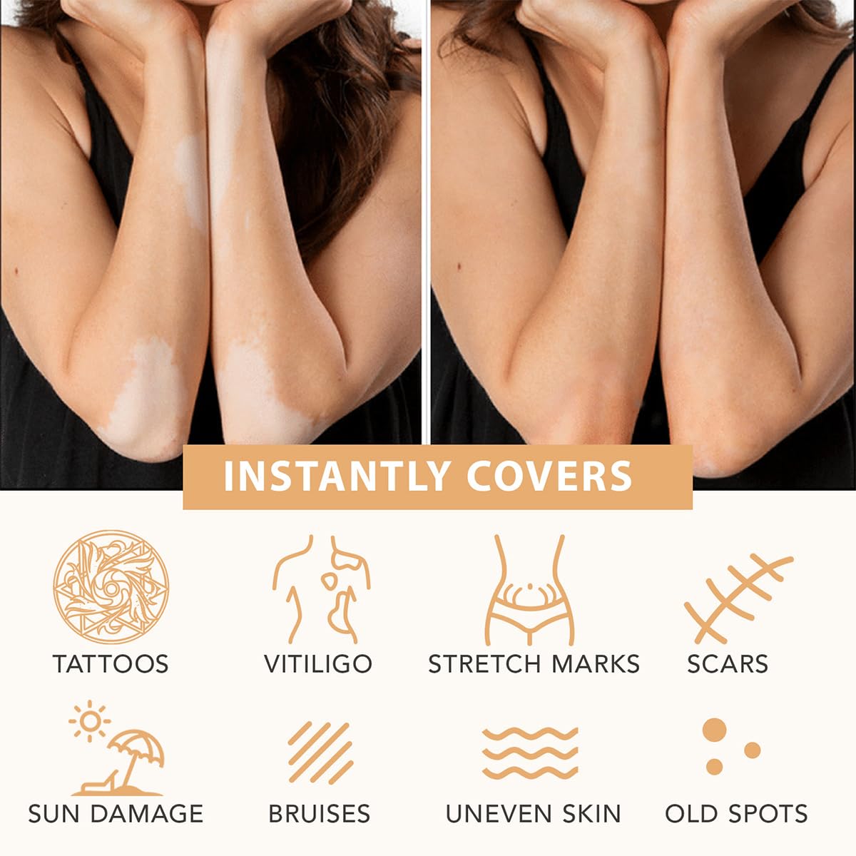 Bekoeen medium glow body concealer applied on skin