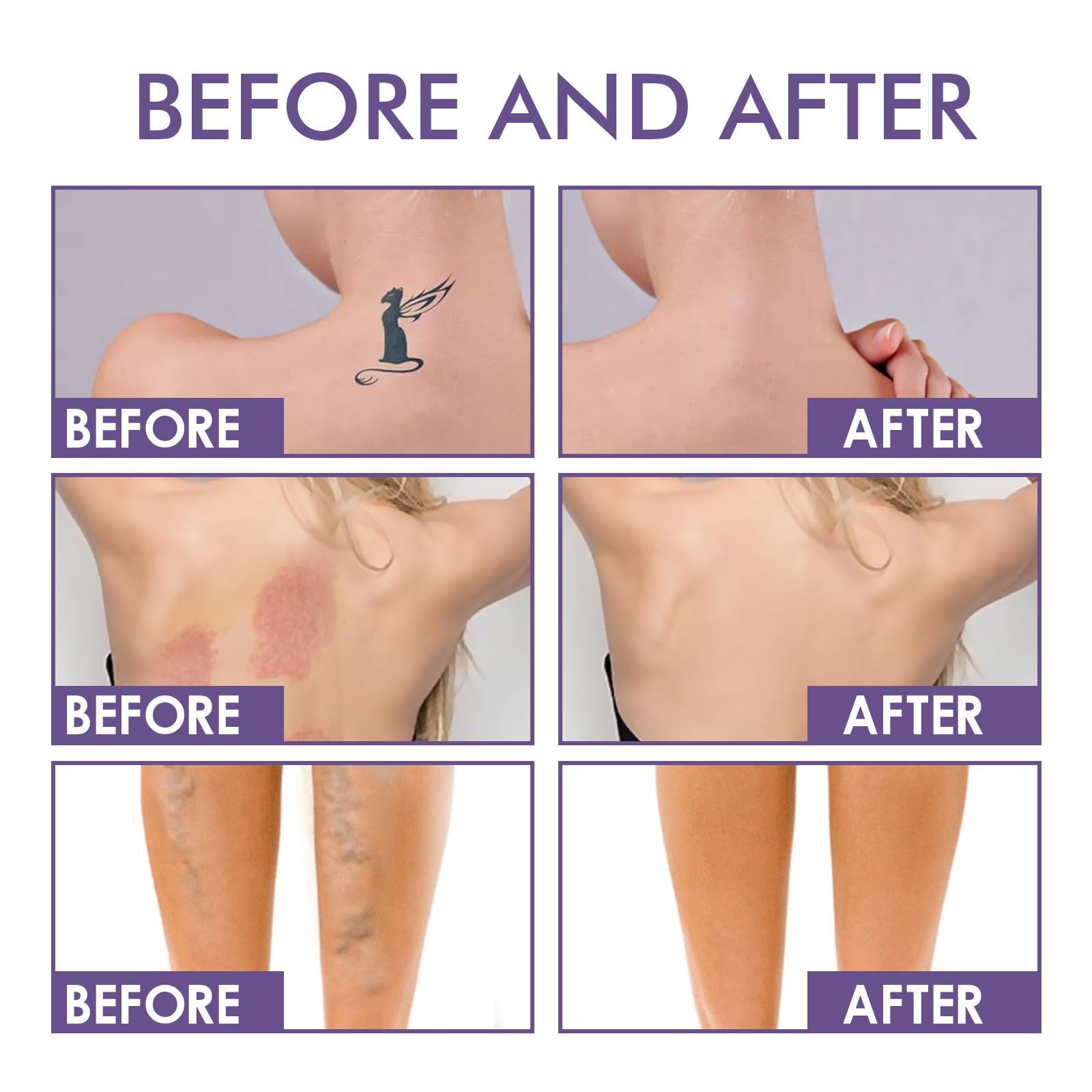 Oykose body concealer before and after usage