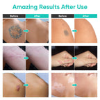 Demonstration of the waterproof body concealer covering arm tattoos