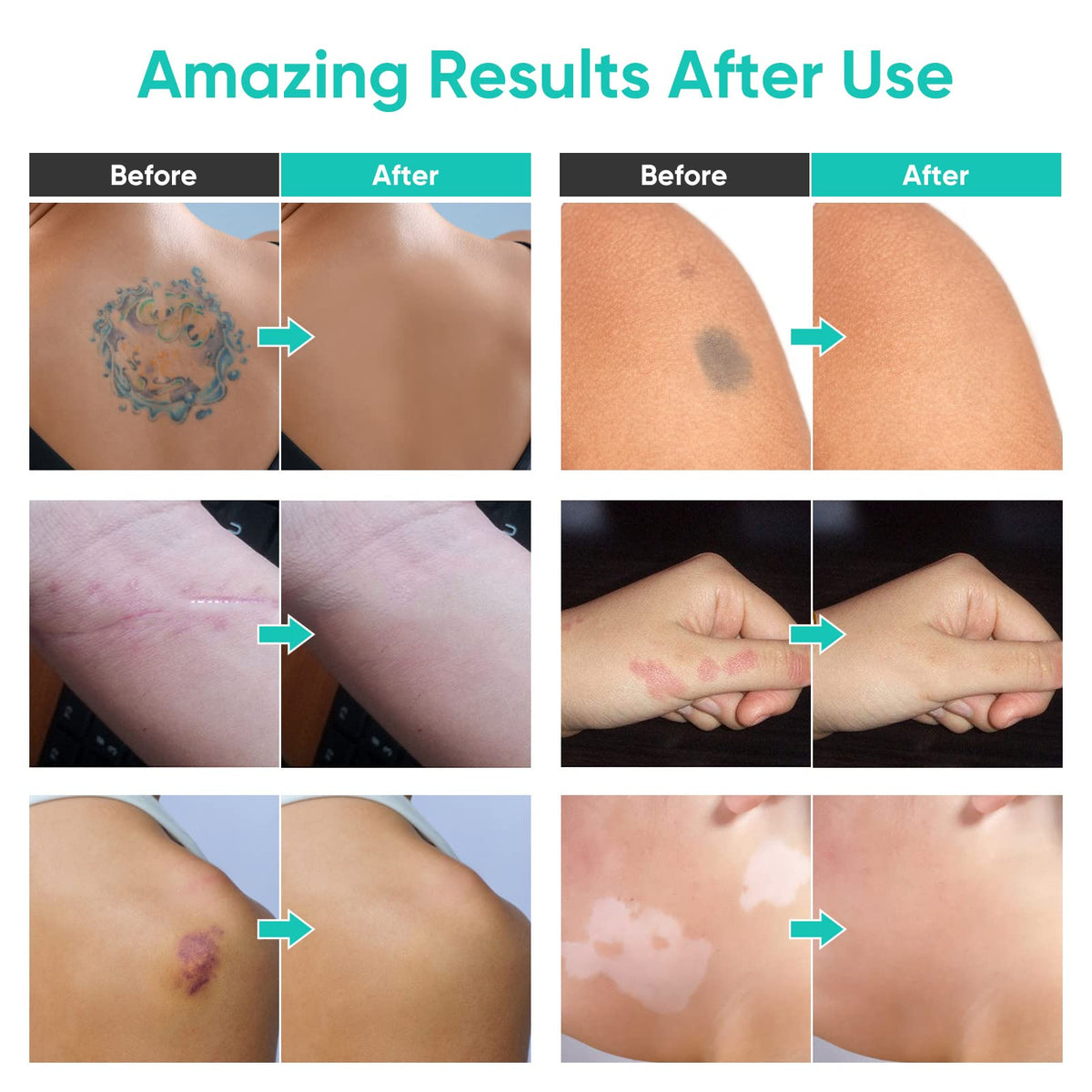 Demonstration of the waterproof body concealer covering arm tattoos