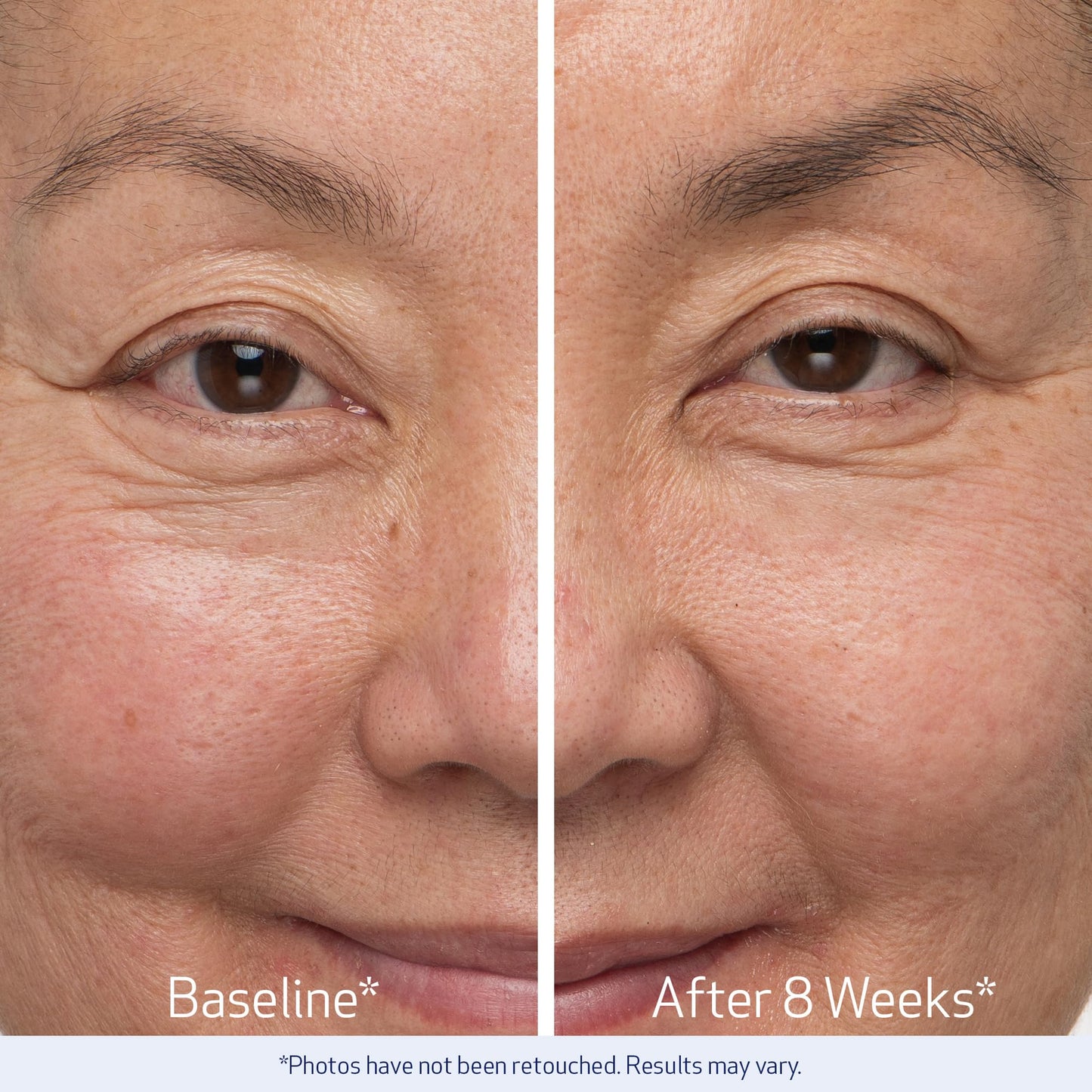 The clinical two piece lash and brow enhancing kit displayed open to reveal the two separate treatment tubes.