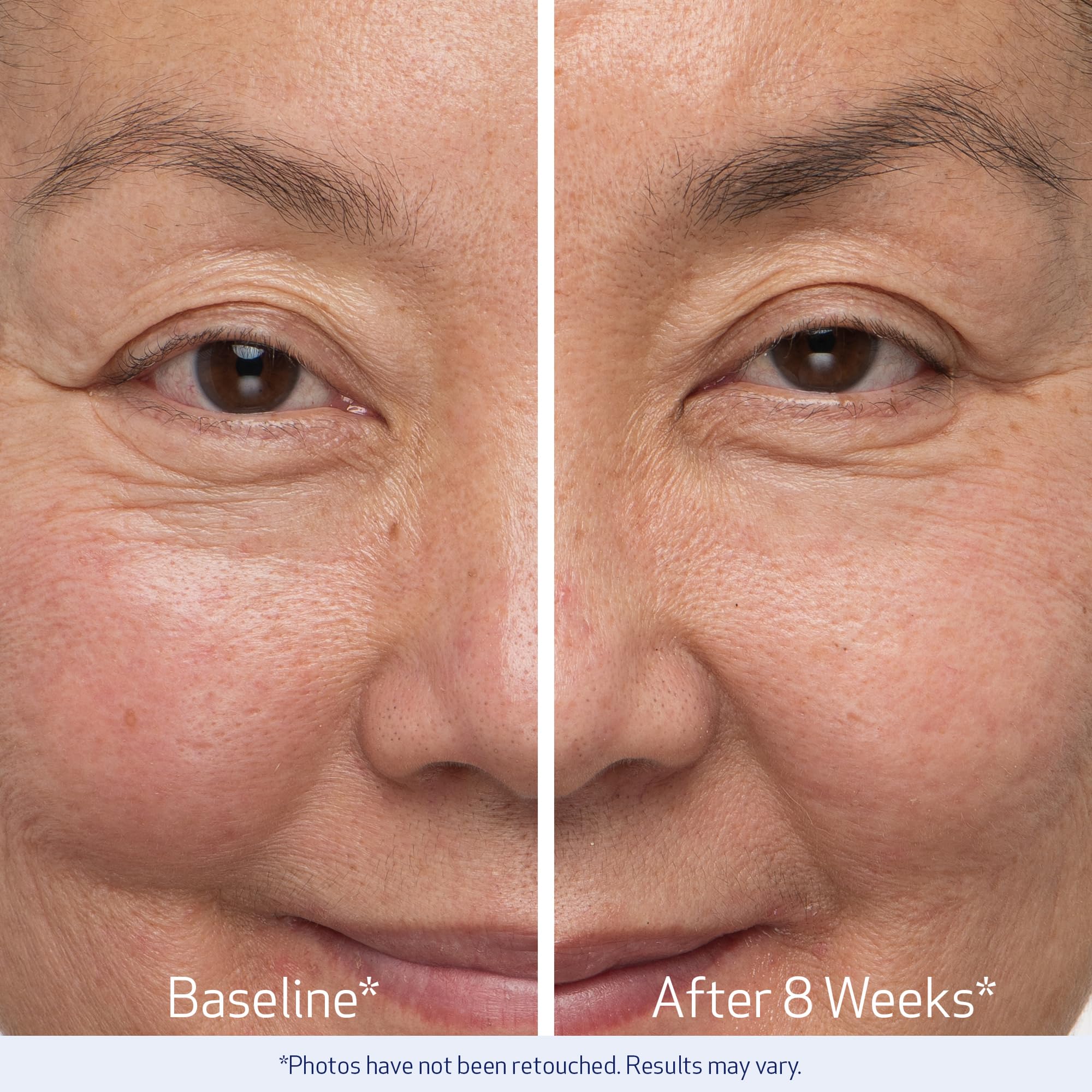 The clinical two piece lash and brow enhancing kit displayed open to reveal the two separate treatment tubes.