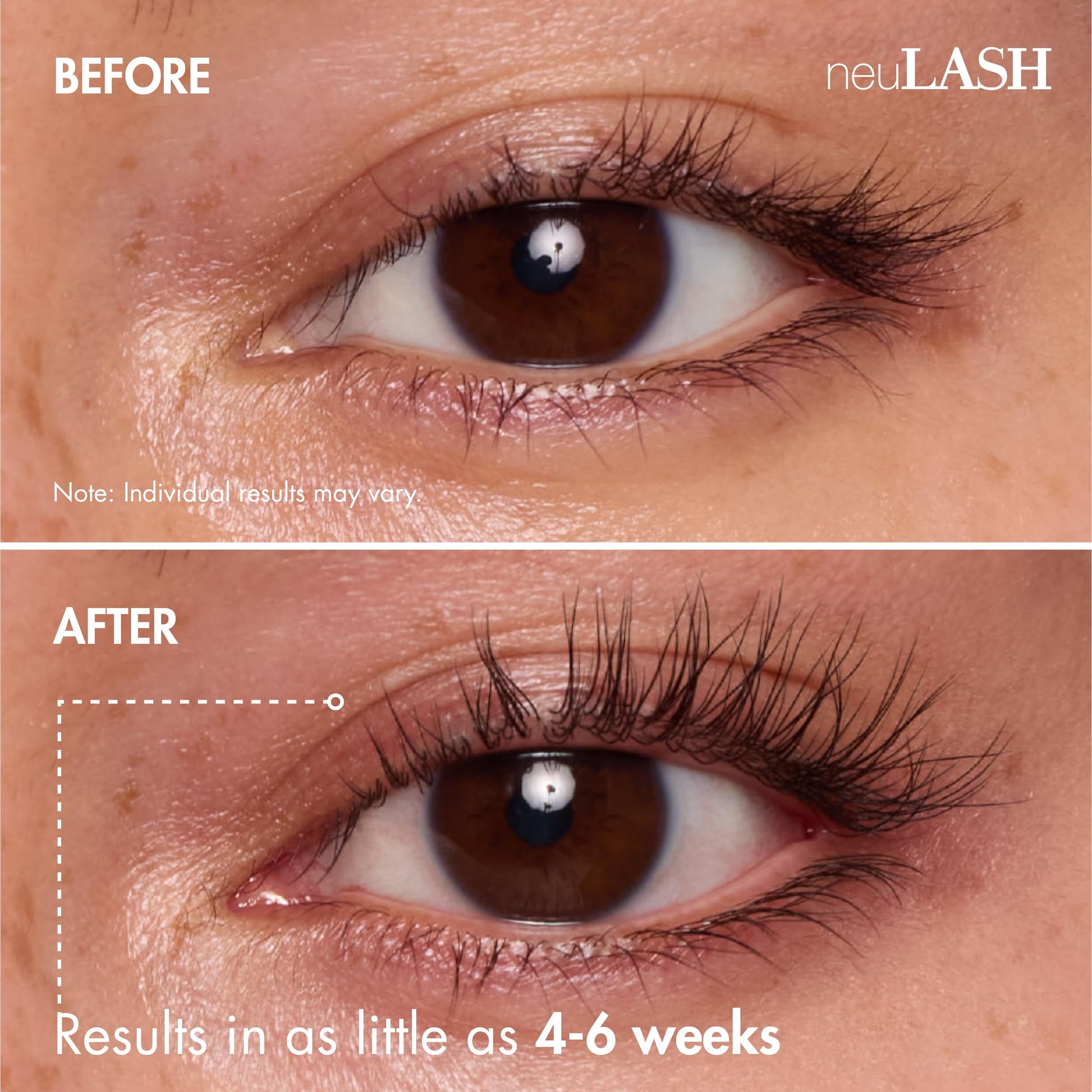 Premium USA imported neuLASH serum for longer looking natural eyelashes