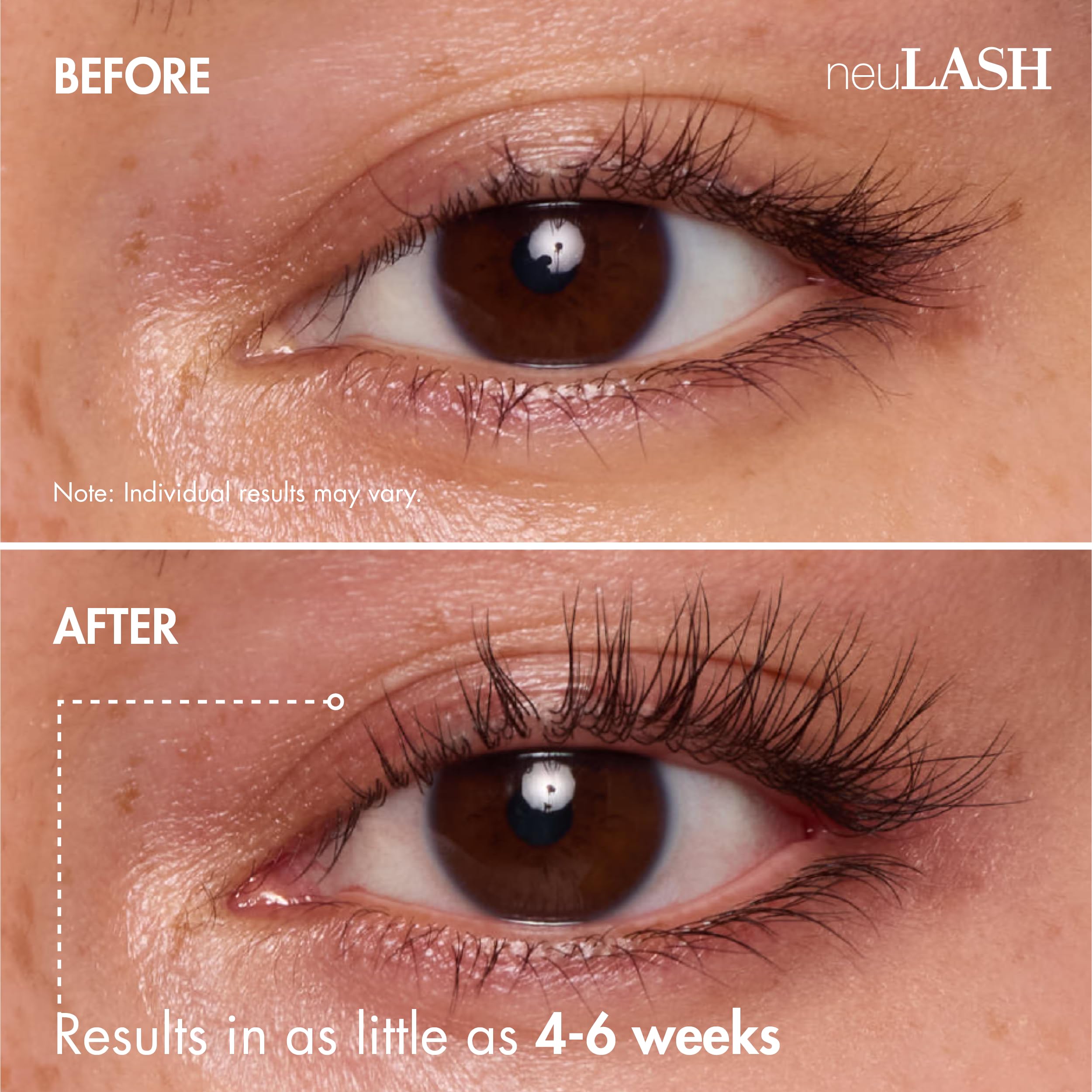 Premium USA imported neuLASH serum for longer looking natural eyelashes
