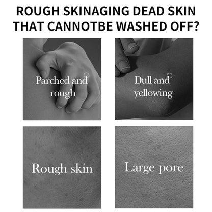 Peeling solution spray bottle showing ingredients like niacinamide and glutathione