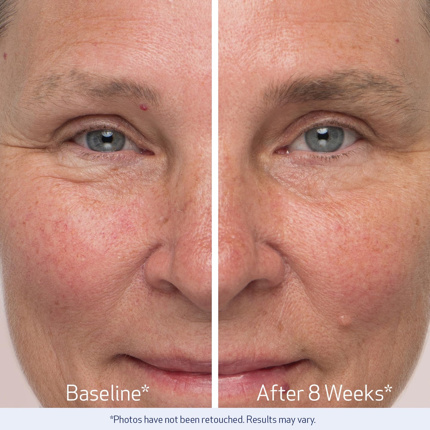 Premium Obagi Medical eyebrow enhancing liquid for sparse brows
