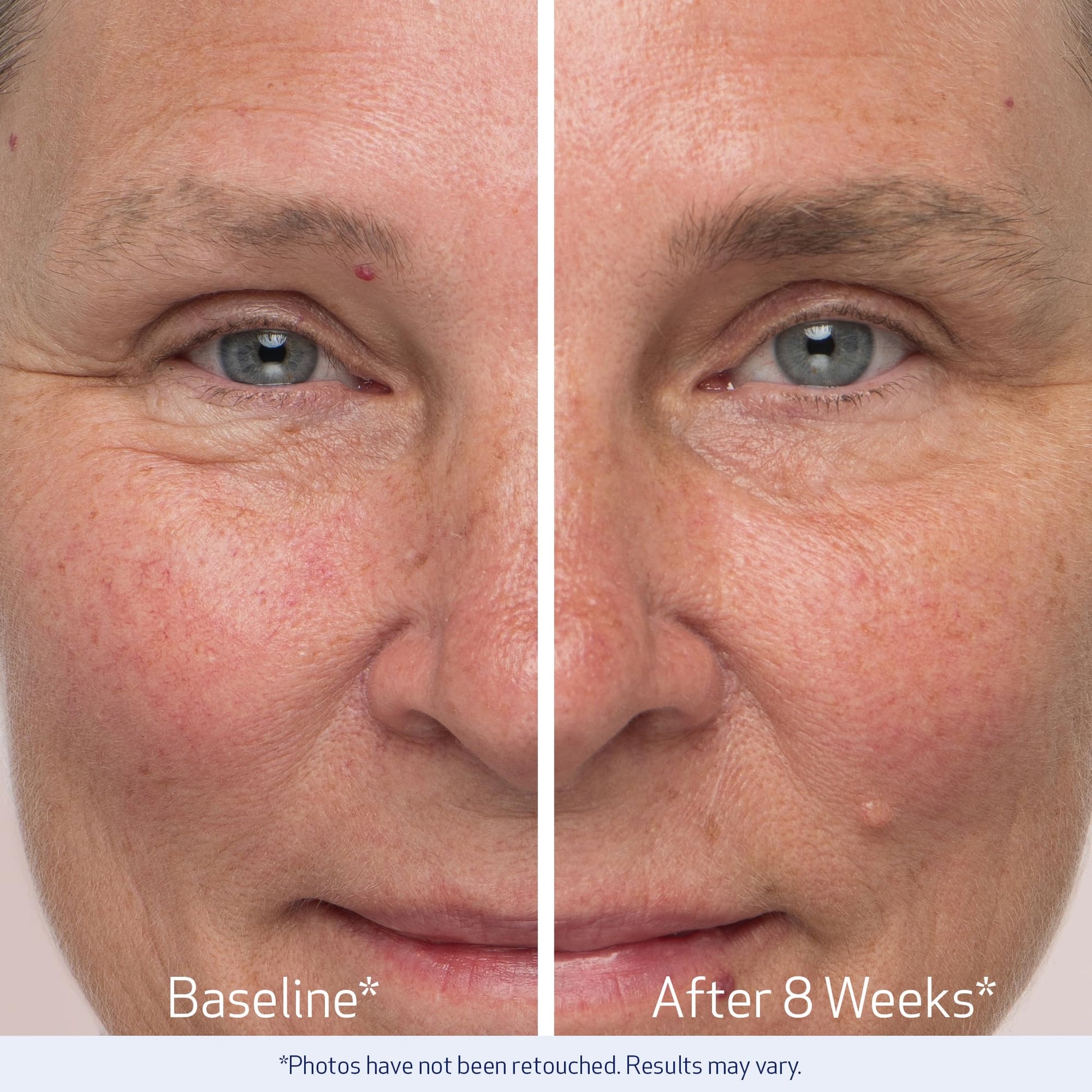 Premium Obagi Medical eyebrow enhancing liquid for sparse brows