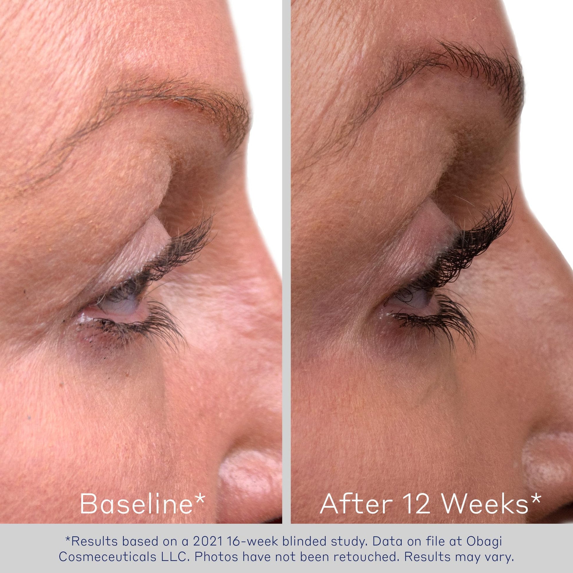 Obagi Nu Cil lash serum box and tube set view