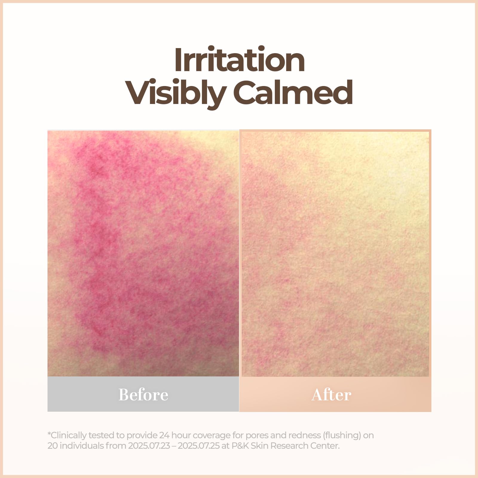 Cell Fusion C Skin Blemish Balm intensive fluid ounce tube.