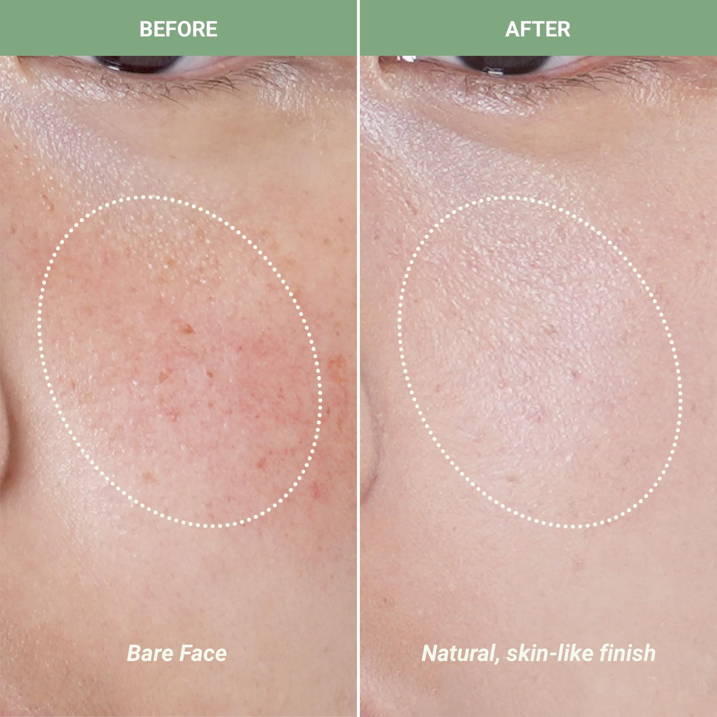 Meebak Cica Redness Solution Cream application on skin