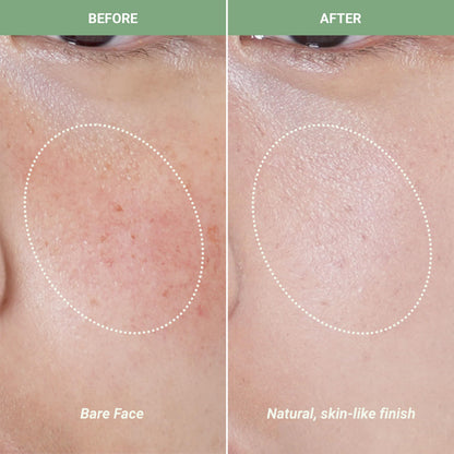 Meebak Cica Redness Solution Cream application on skin