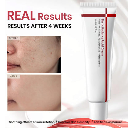OUSHANG wrinkle reduction facial cream showcasing the lightweight formula consistency.