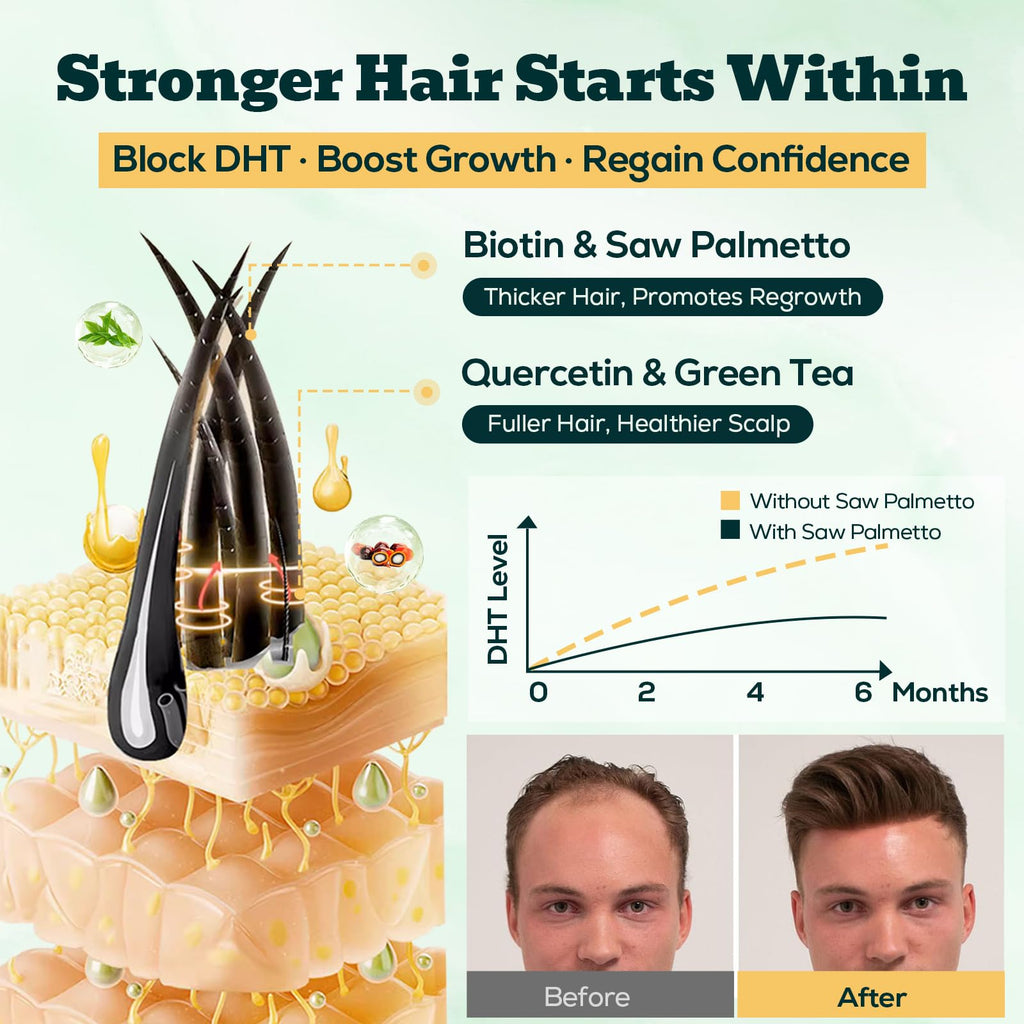 EnvyDeal hair growth supplement showing two bottles of sixty passionfruit dragonfruit flavored gummies.