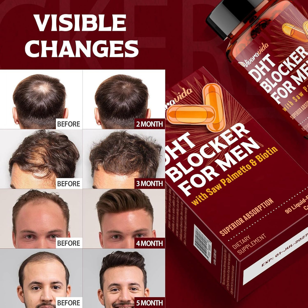 Vivaravida premium imported hair health supplement for men close up