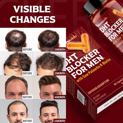Vivaravida premium imported hair health supplement for men close up