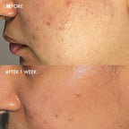 Close up of Dermisa facial soap texture