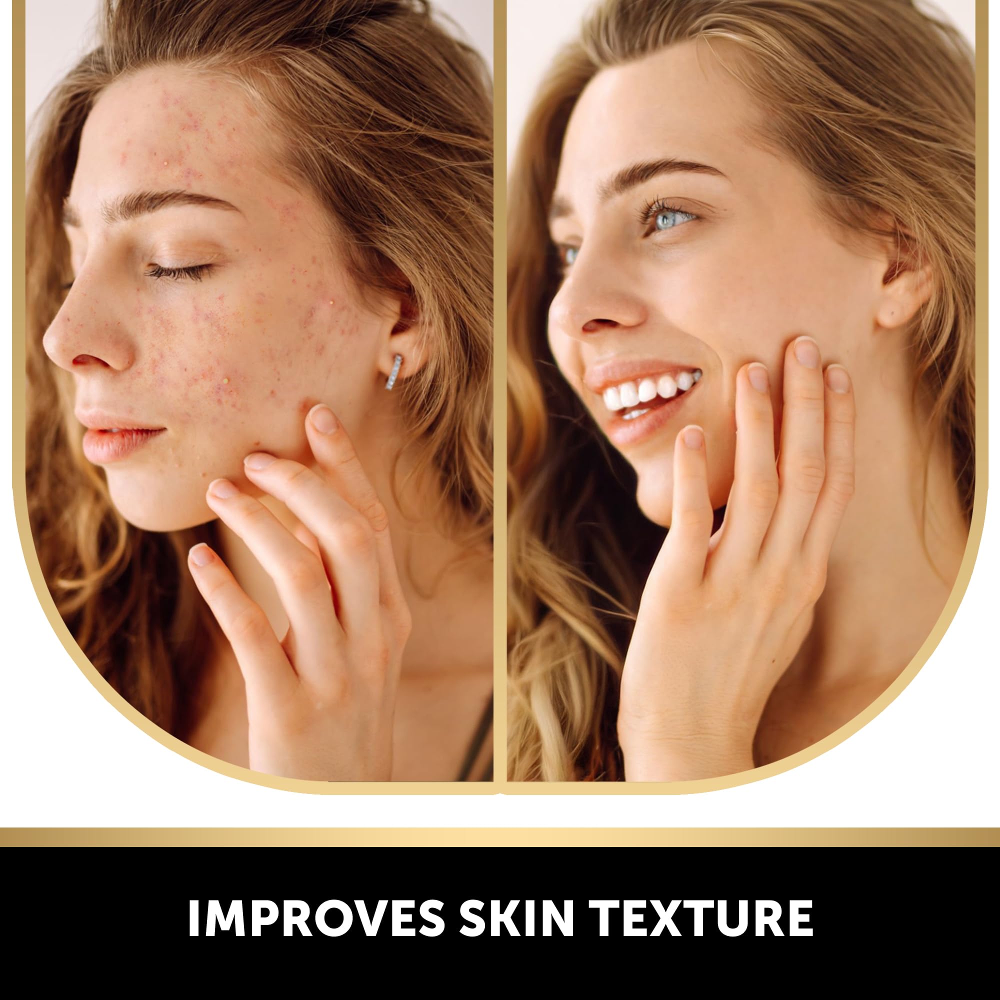 VALITIC hyperpigmentation clearing soap bar with visible turmeric and collagen infusion.