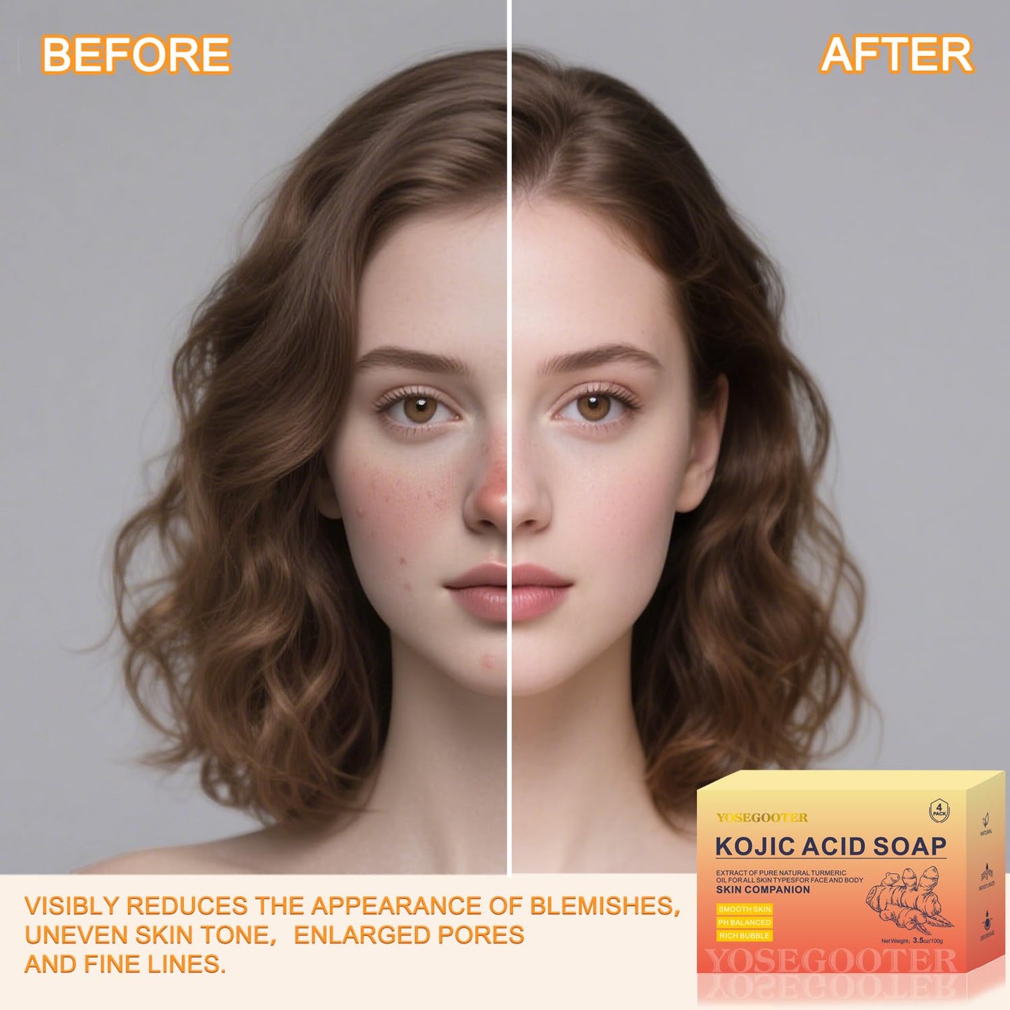 Authentic imported Yosegooter kojic acid soap bars for evening skin tone