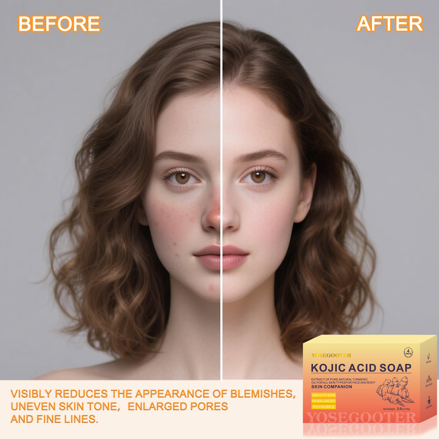 Authentic imported Yosegooter kojic acid soap bars for evening skin tone