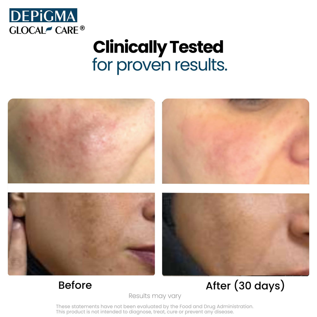 Close up of GlocalCare Depigma packaging and branding