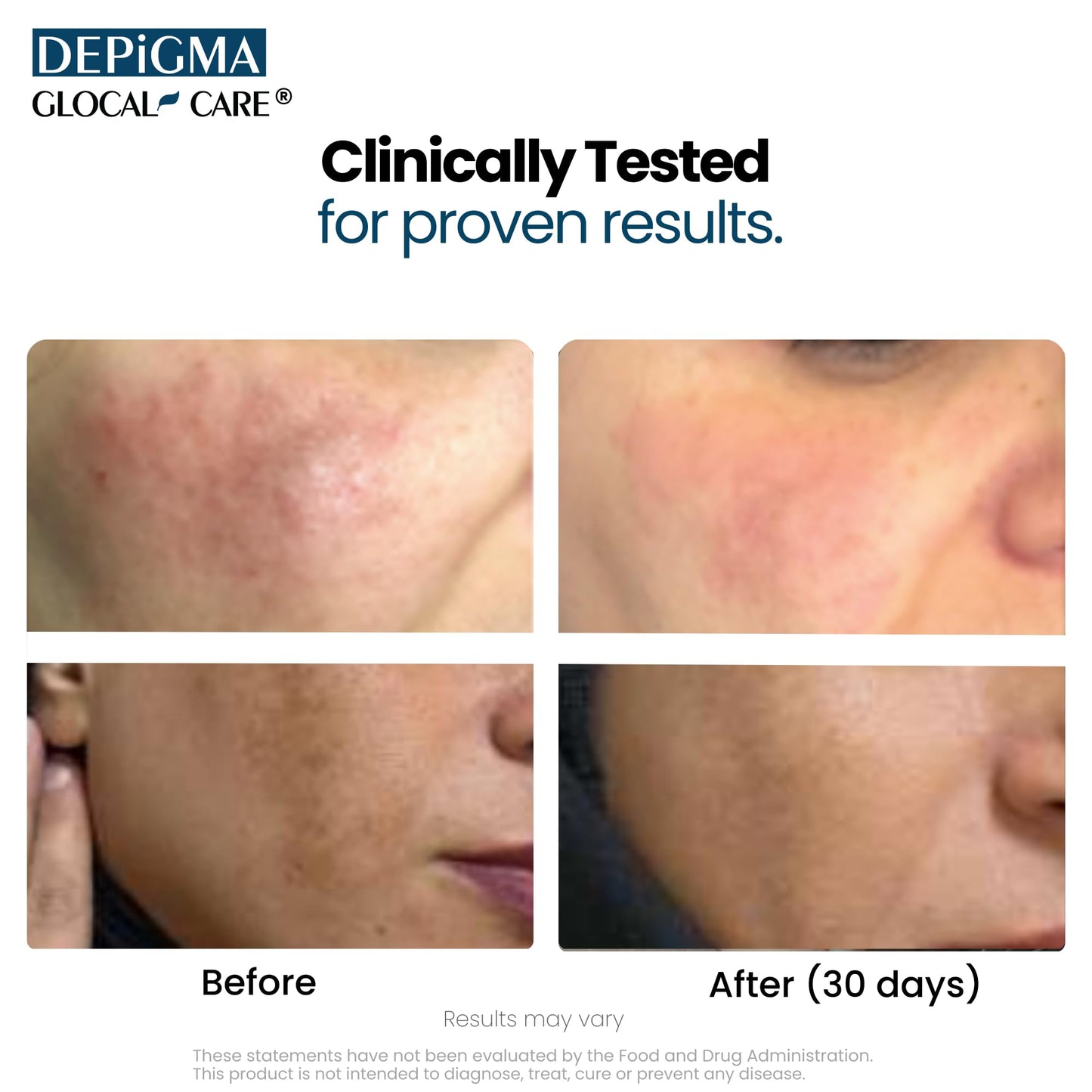 Close up of GlocalCare Depigma packaging and branding