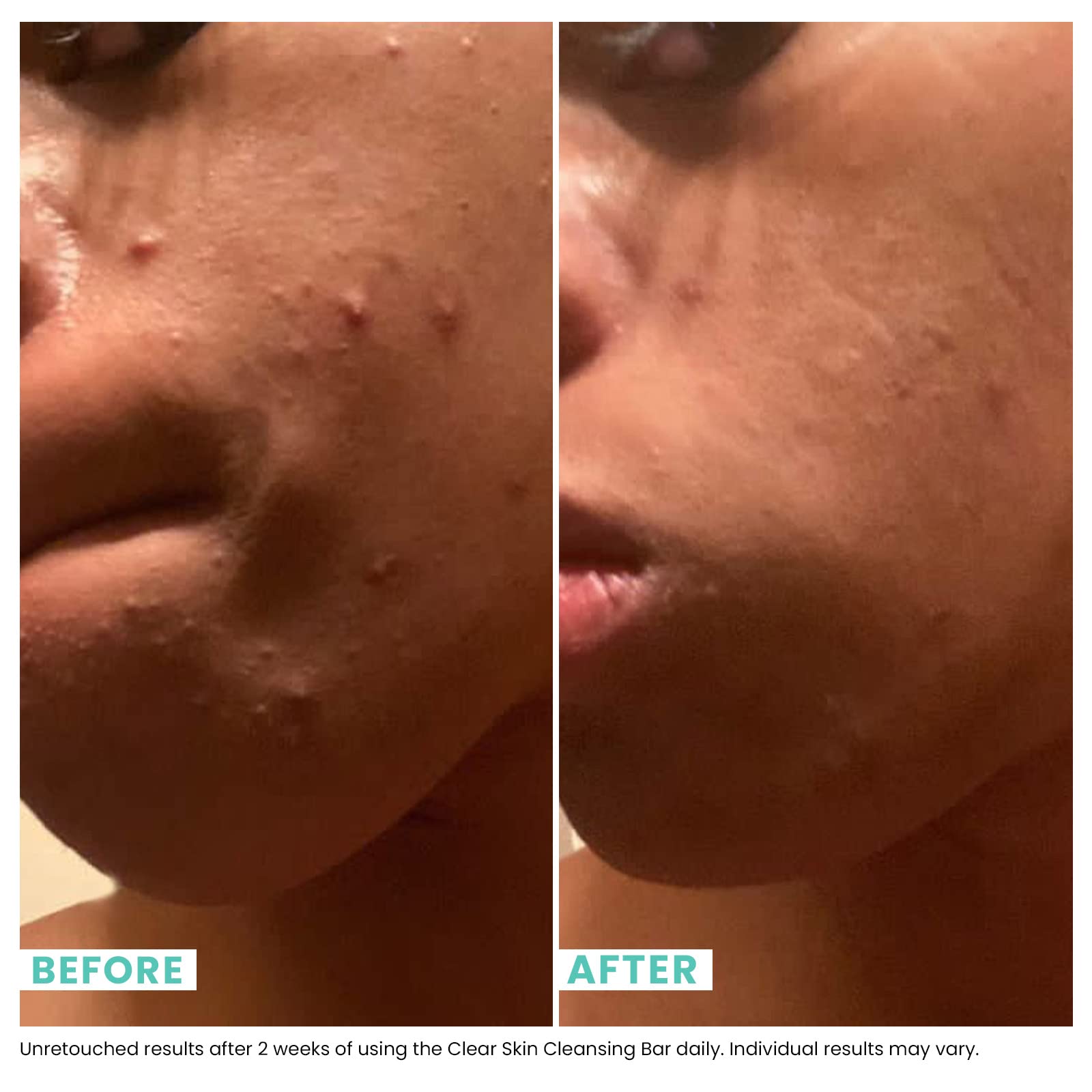 Urban Skin Rx ClearSkin 3-in-1 treatment mask application steps visual