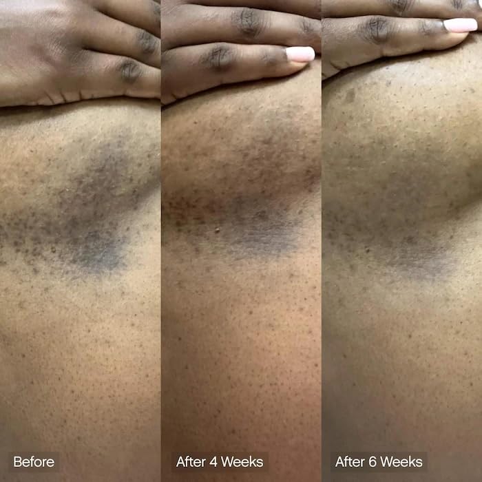 Topicals Faded soap bar application on hand