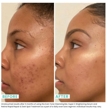 Back label of Urban Skin Rx daily multitasking treatment bar showing correct application steps