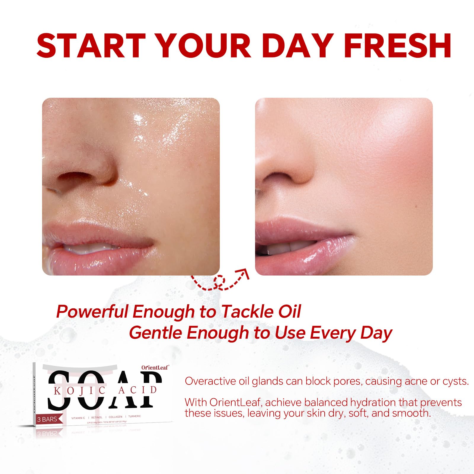 Gentle face and body wash kojic acid soap bar creating a rich lather on skin