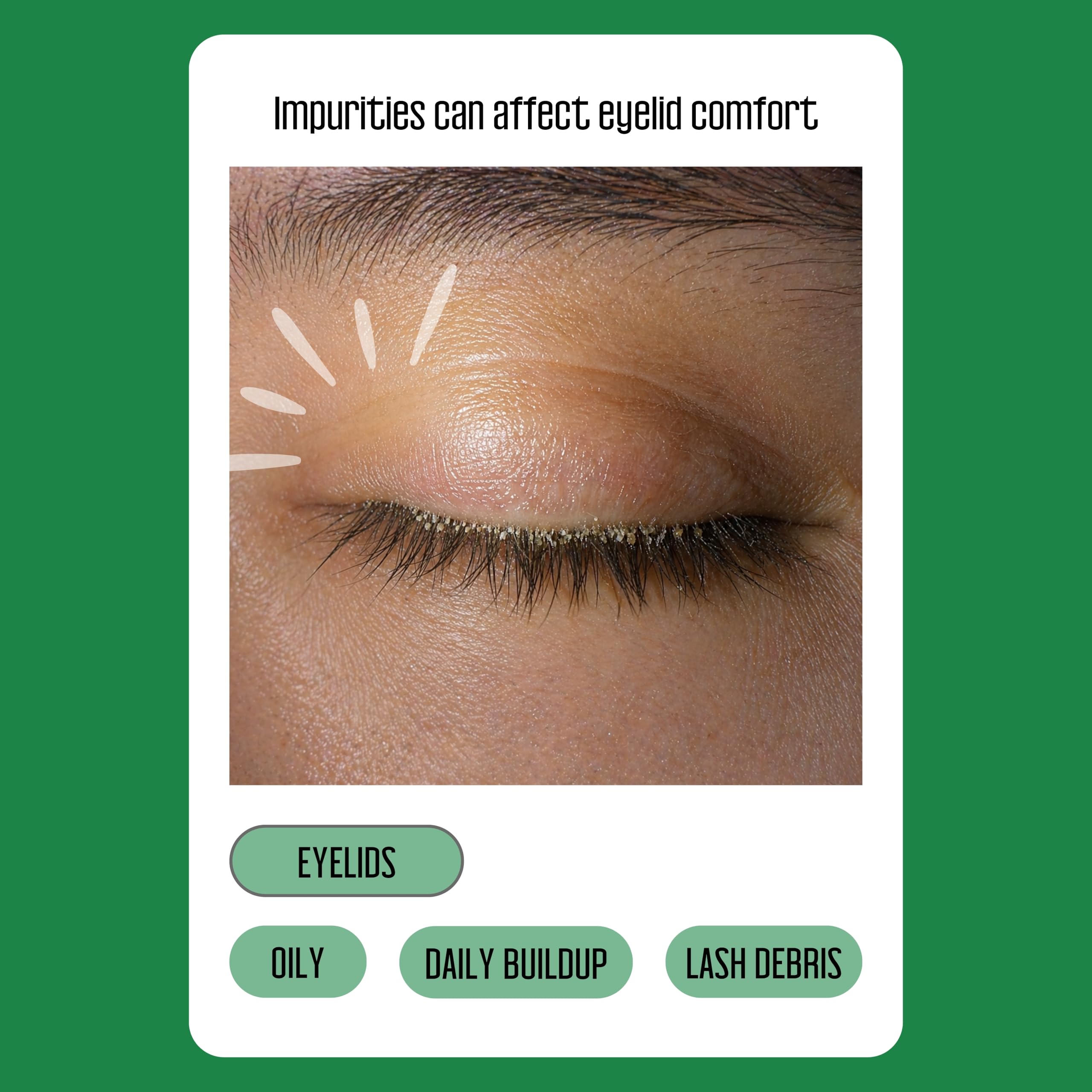 Close up of tea tree oil eyelid wipes texture