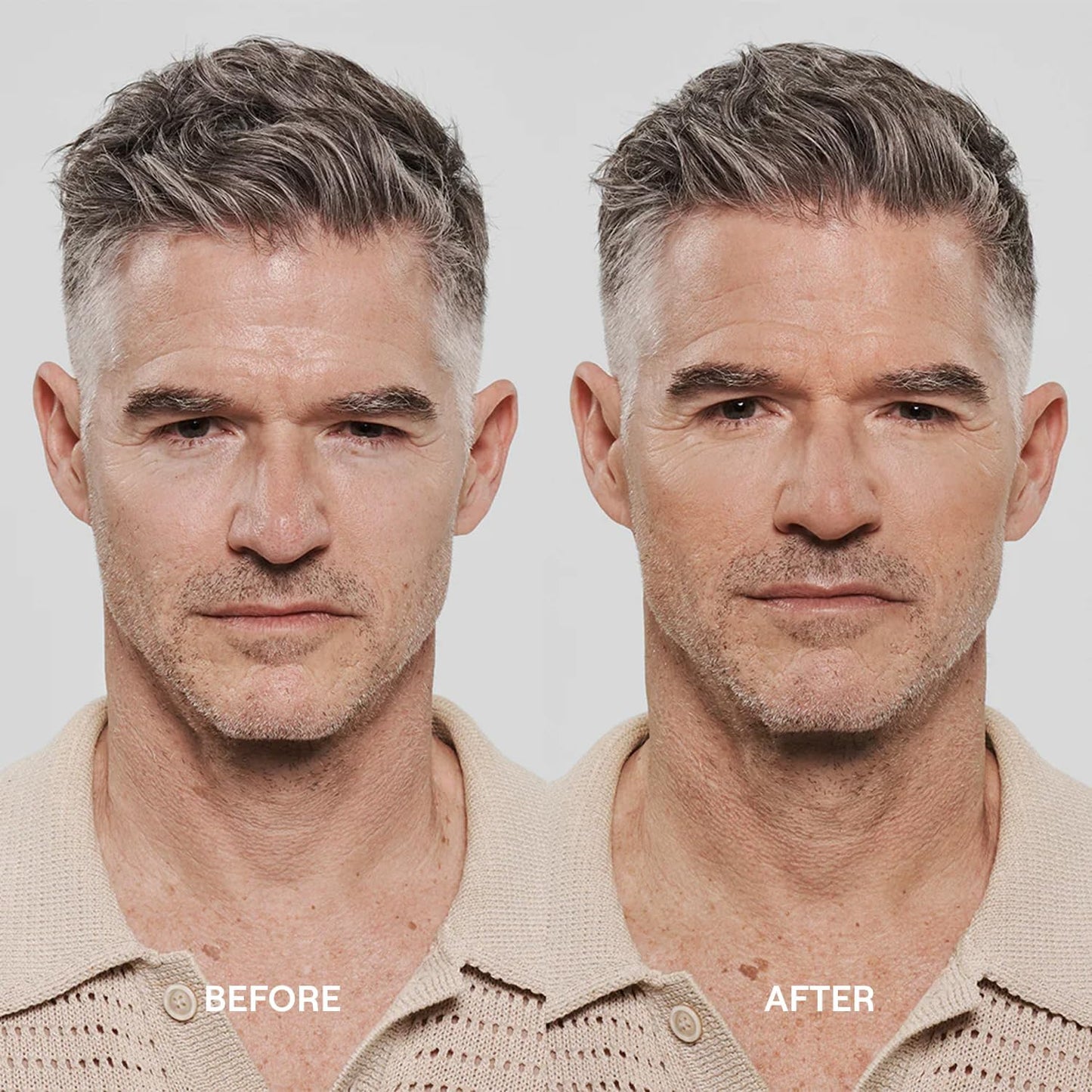 Hydrating face cream for men designed to reduce fine lines and acne scars.