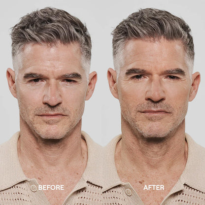 Hydrating face cream for men designed to reduce fine lines and acne scars.