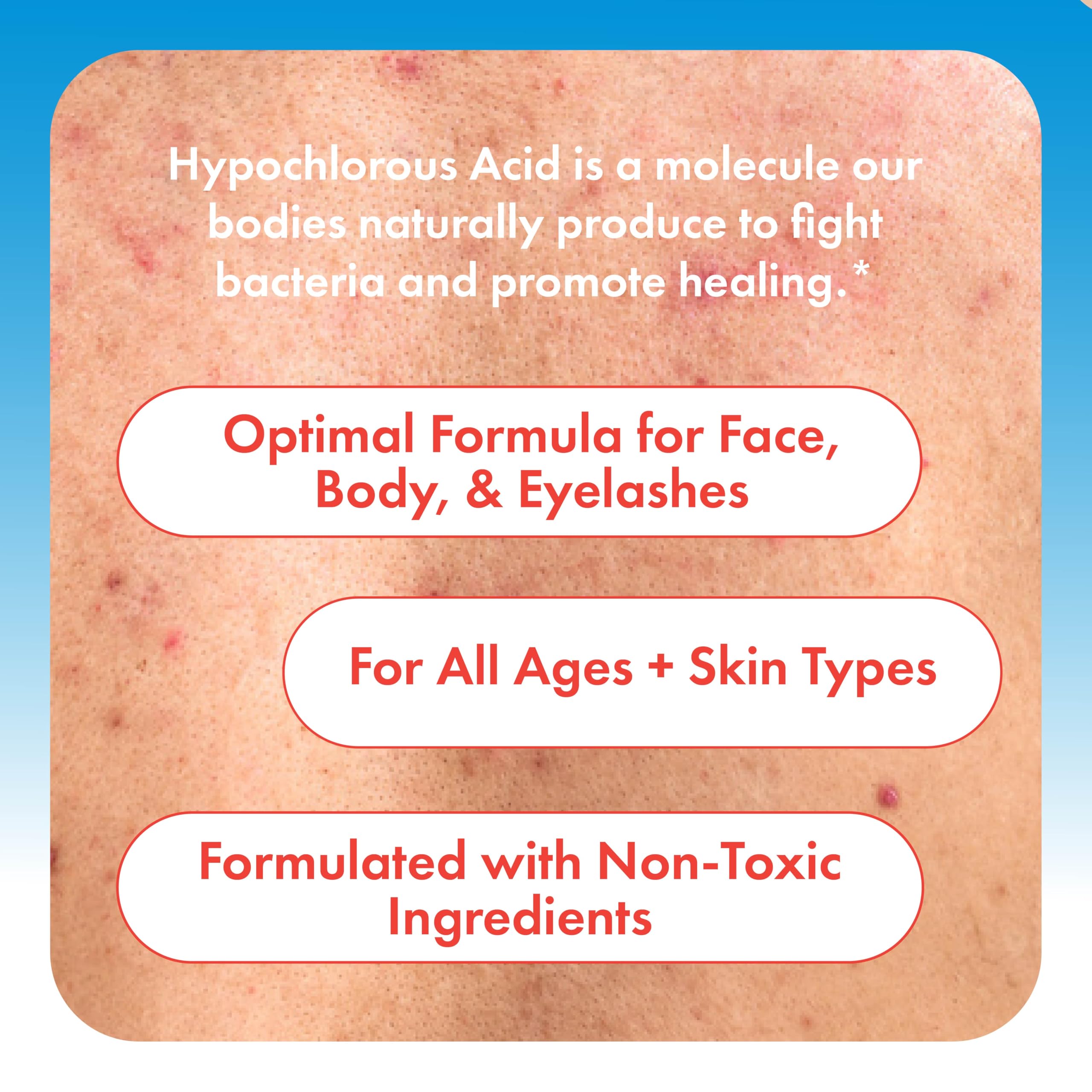 Authentic HypoClear skincare spray bottle for acne and sensitive skin