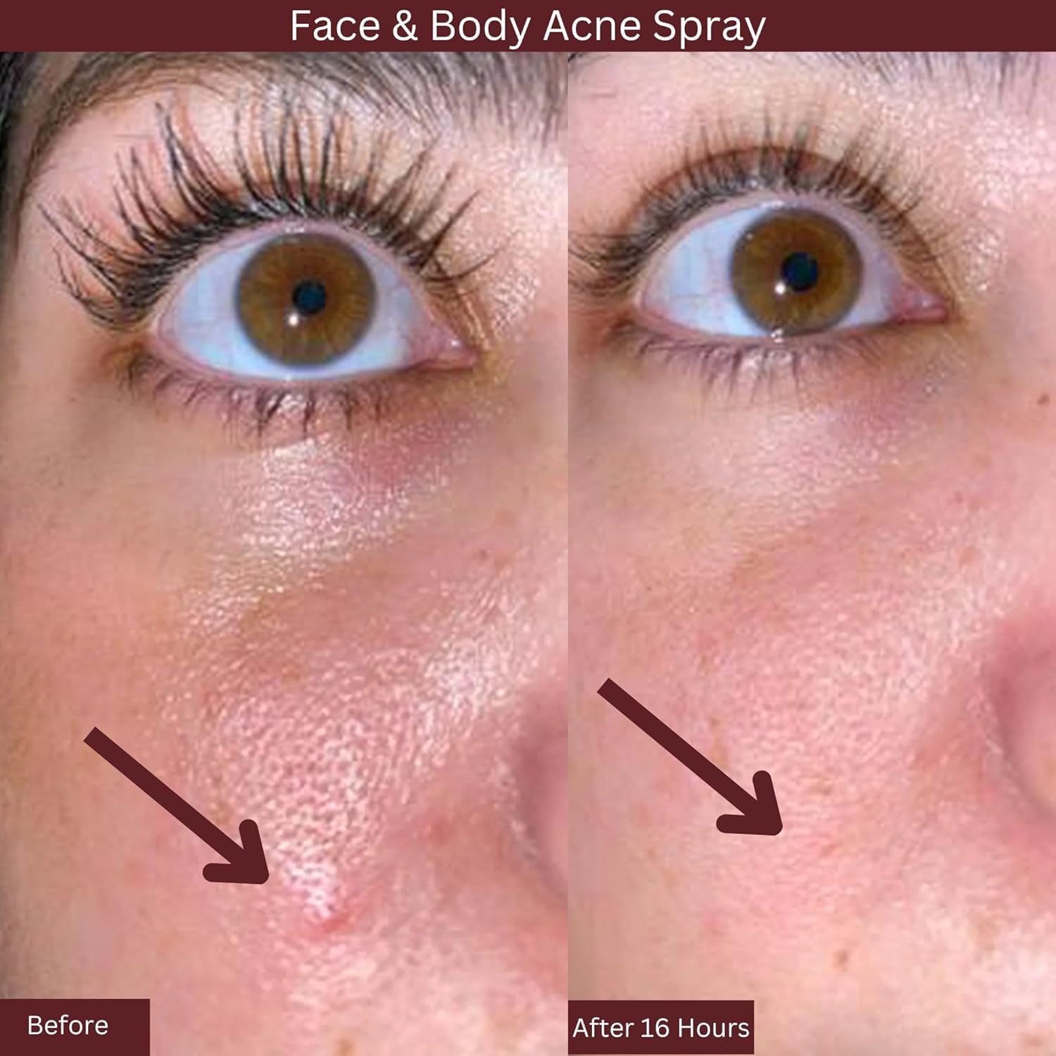Detailed label of ITK 2 percent salicylic acid mist ingredients