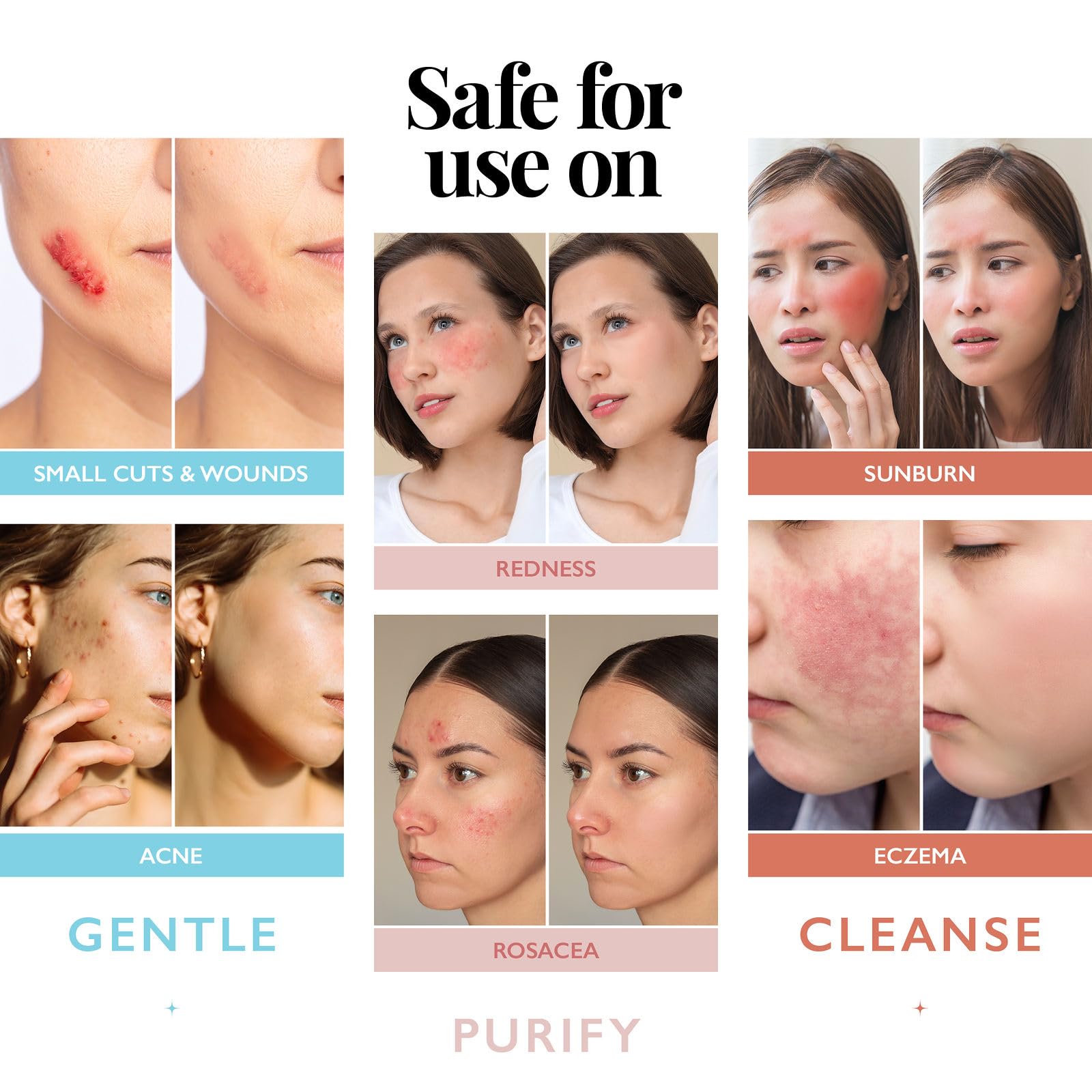 Person using Aquia facial mist as an acne cleanser