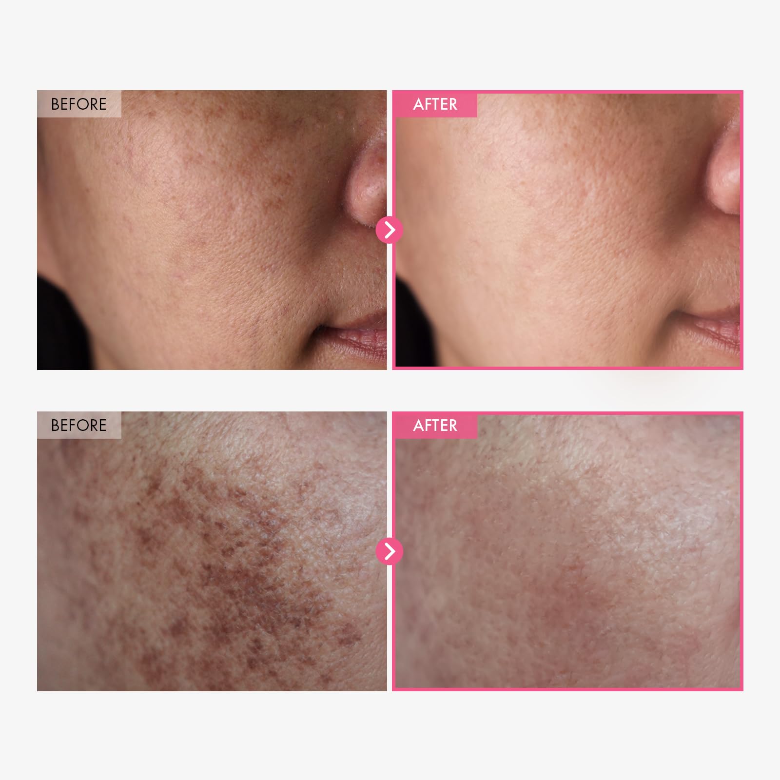 Korean brightening face cream with arbutin and tranexamic acid for fading dark spots