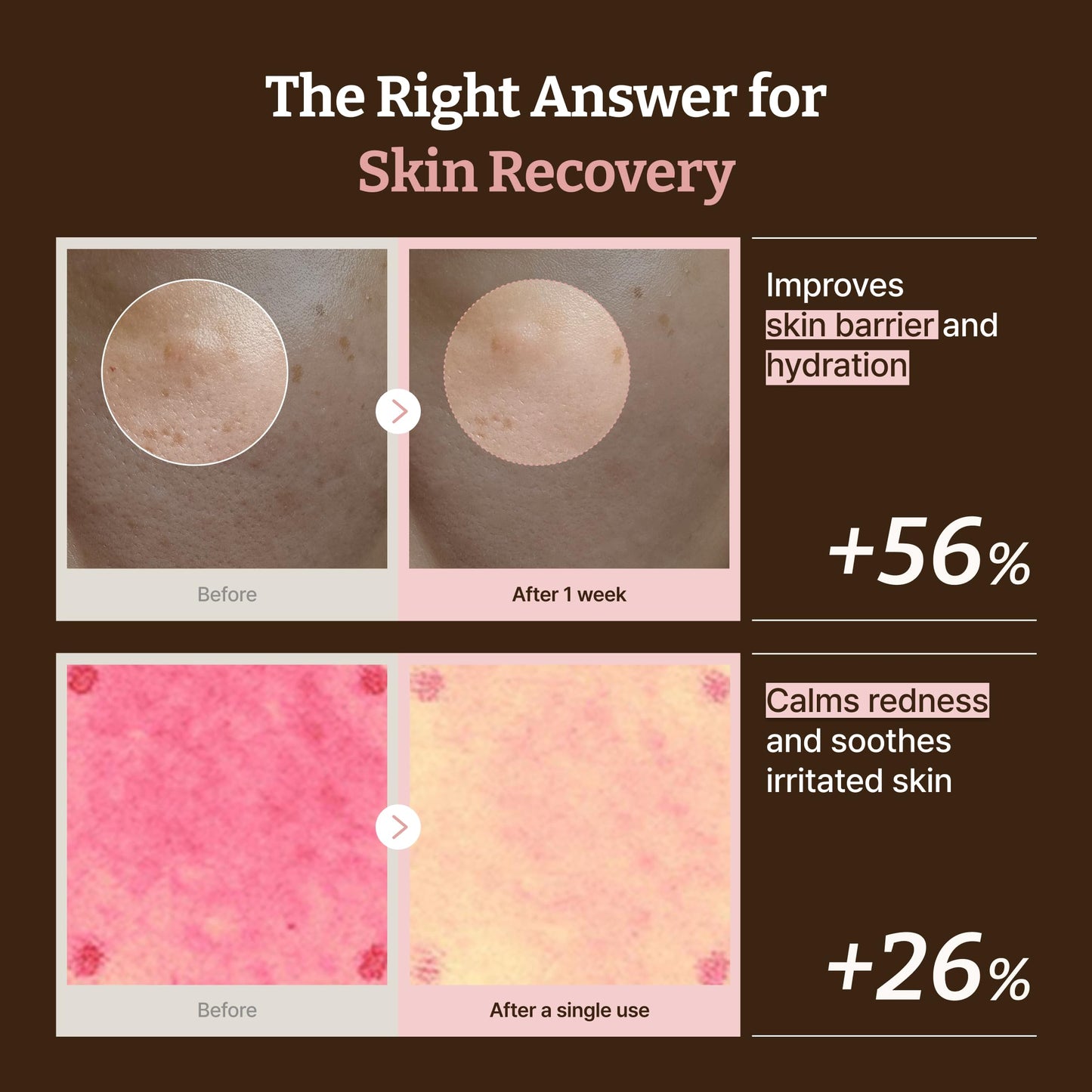 Dr. Reju-All PDRN cream ingredients and product details