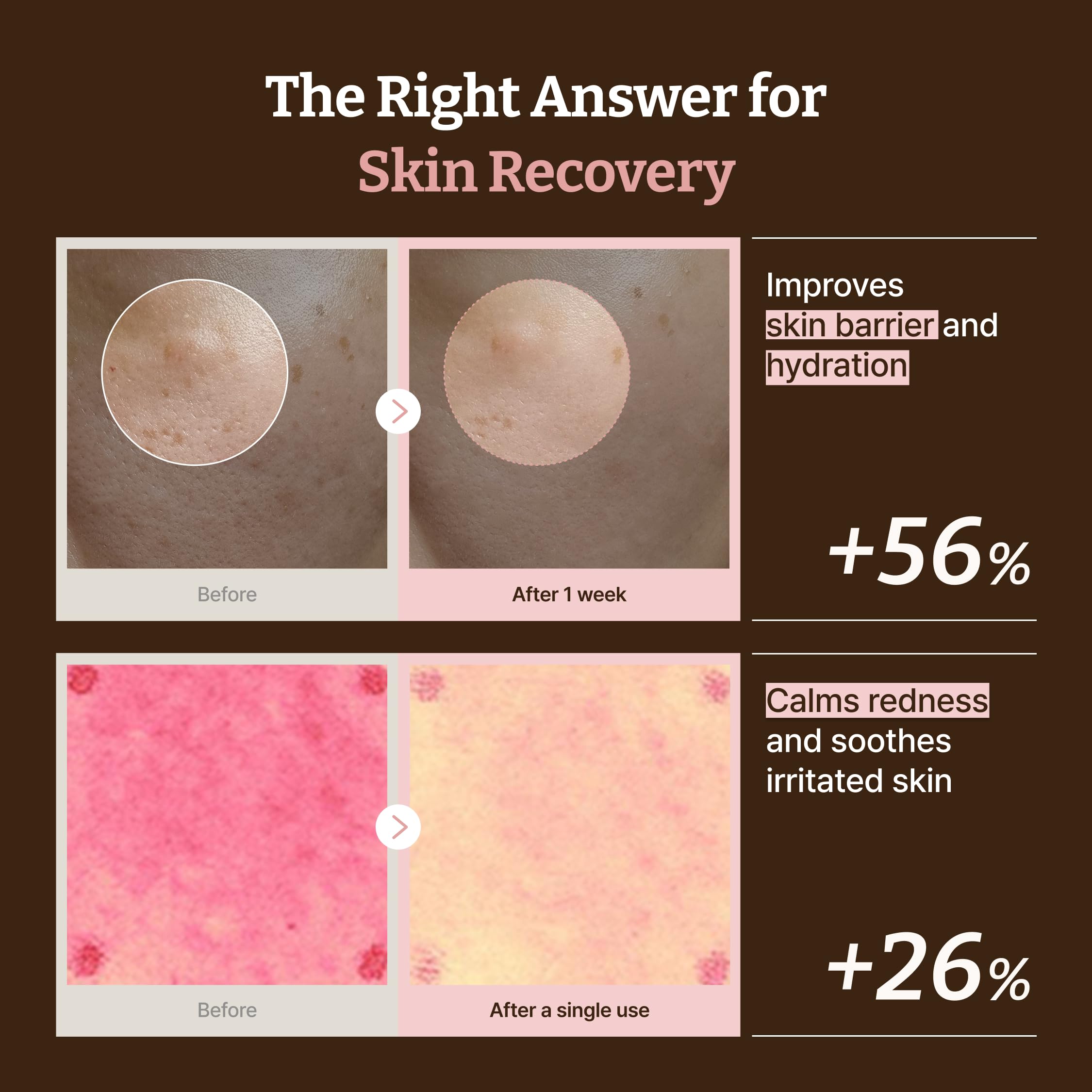 Dr. Reju-All PDRN cream ingredients and product details