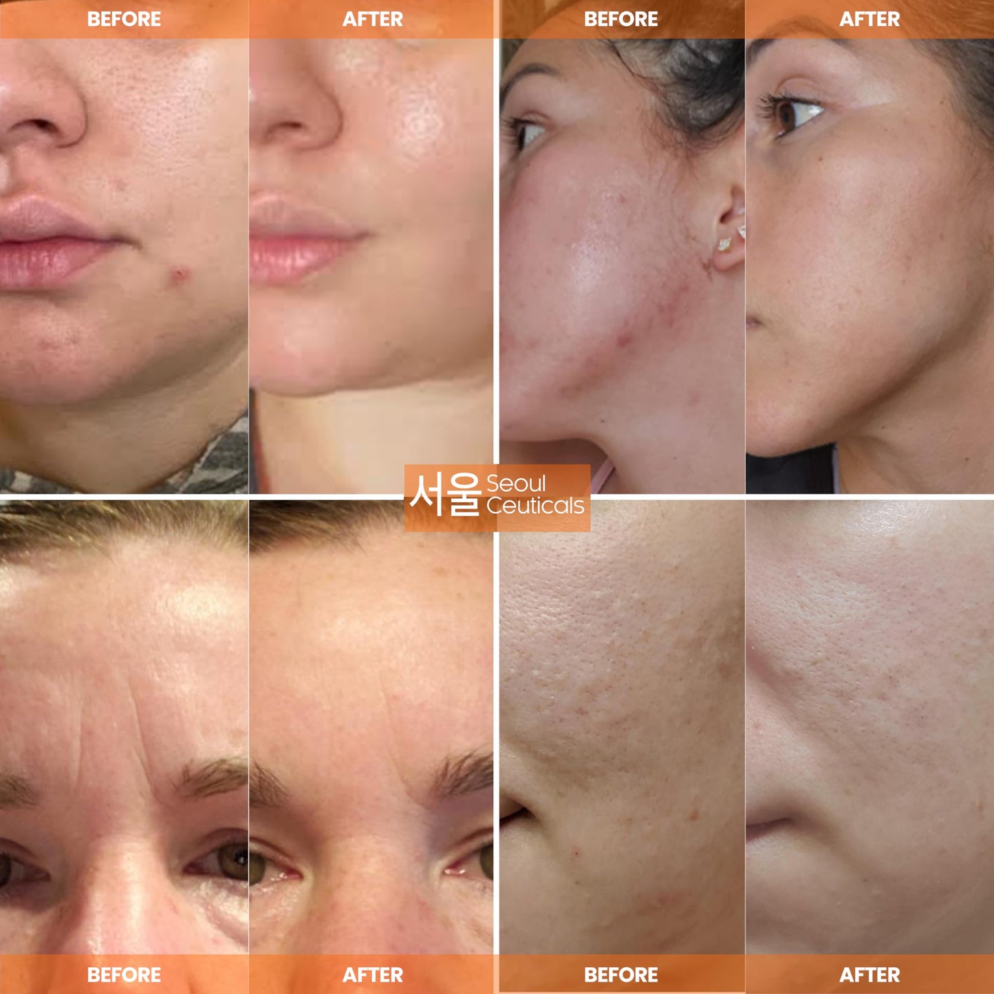 SeoulCeuticals Korean skin care multi-function all-in-one anti-aging cream side view