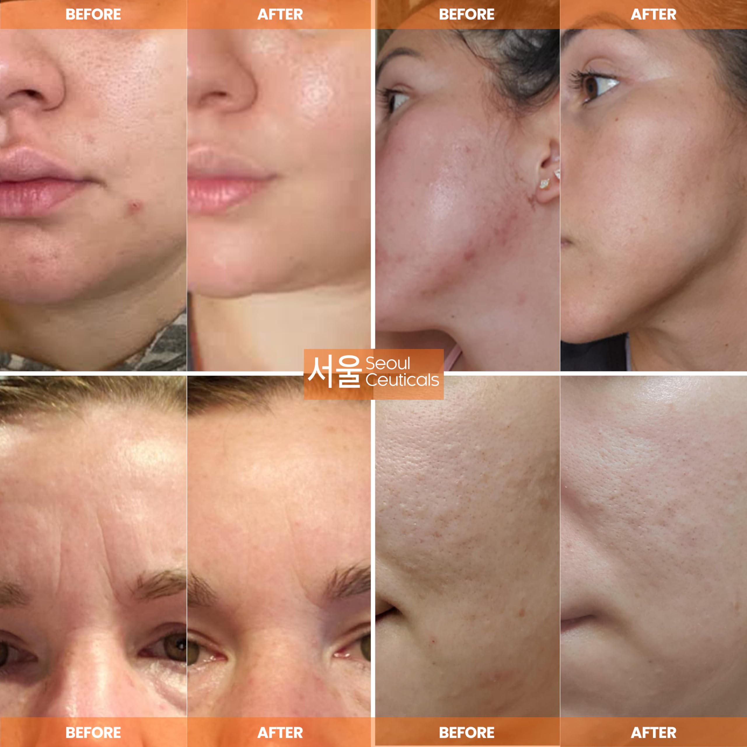 SeoulCeuticals Korean skin care multi-function all-in-one anti-aging cream side view