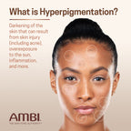 Ambi Even And Clear Advanced Fade Cream active ingredients label