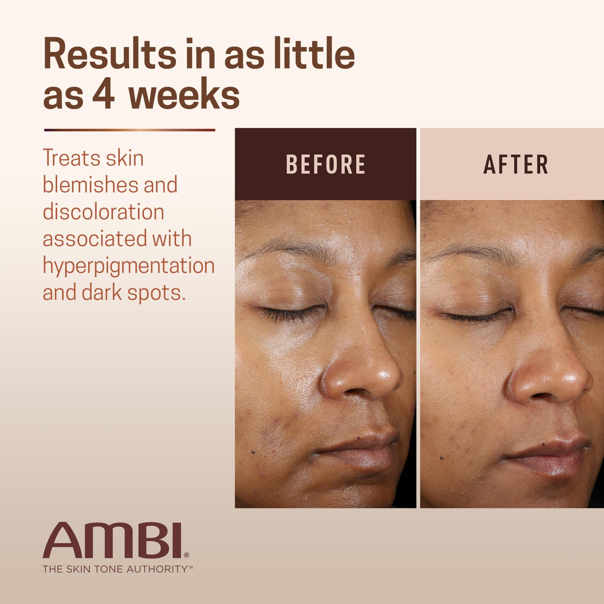 Authentic USA imported Ambi advanced fade cream box and tube setup
