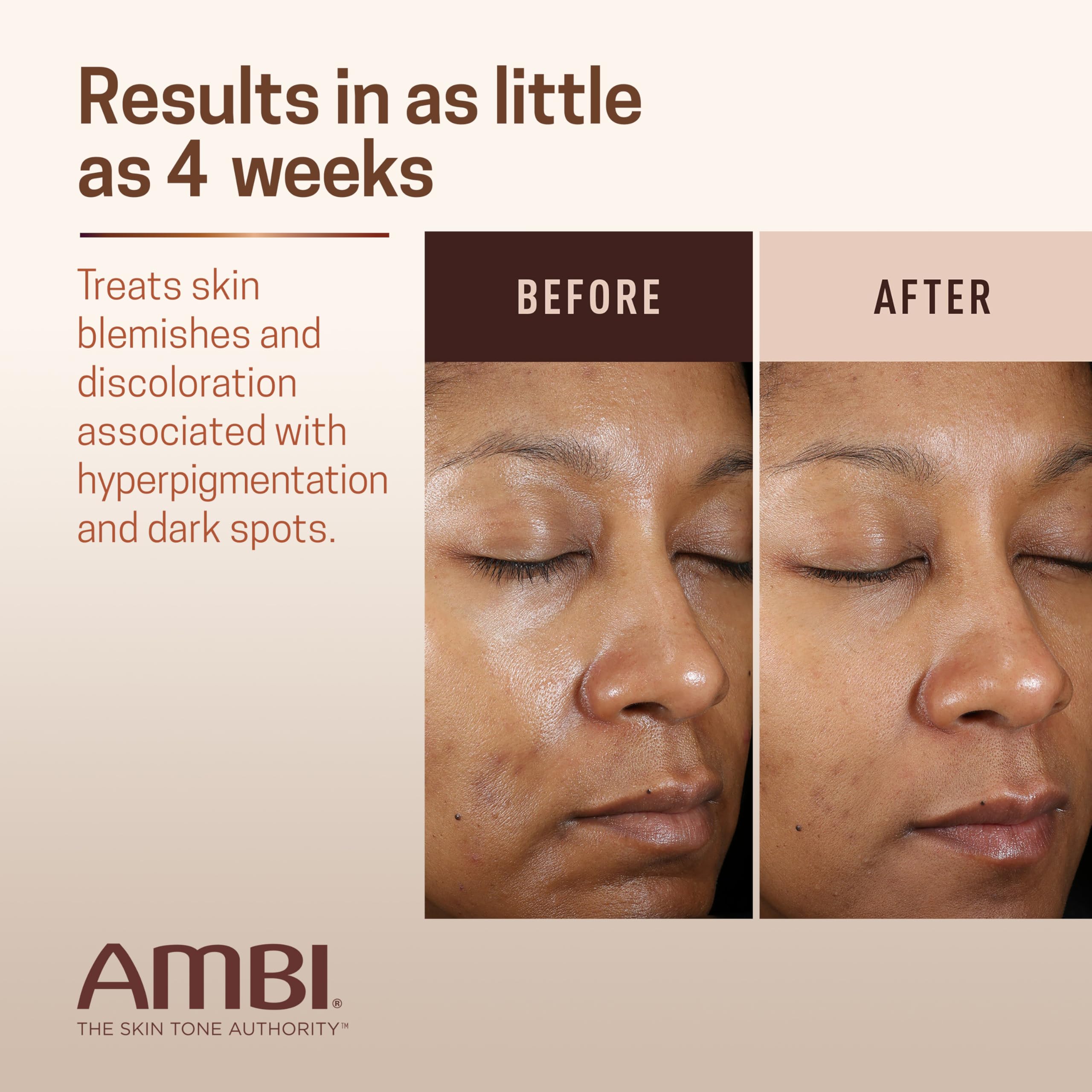 Authentic USA imported Ambi advanced fade cream box and tube setup
