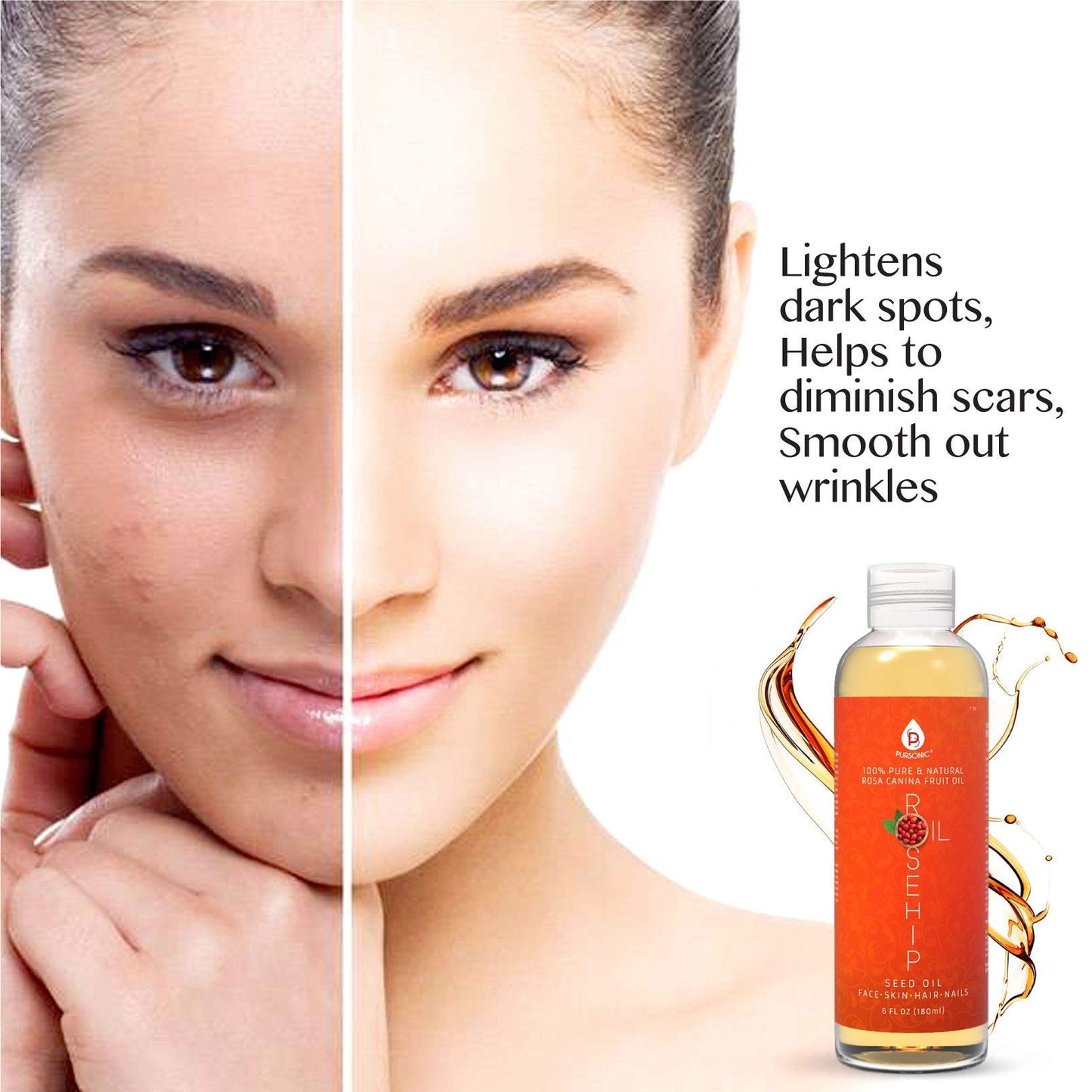 Pursonic 100 percent pure rosehip fruit oil size comparison showing the generous six fluid ounce bottle capacity